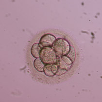 Έμβρυο 3ης ημέρας στο στάδιο των 12 κυττάρων 1ης βαθμίδας με  απουσία θρυμματισμού. Αν και μορφολογικά άριστο, θεωρείται υπερβολικά προχωρημένο για έμβρυο 3ης ημέρας από πλευράς αριθμού βλαστομεριδίων.