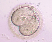 Έμβρυο 2ης ημέρας στο στάδιο των 2 κυττάρων 2ης βαθμίδας με μικρό ποσοστό θρυμματισμού.