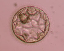 Έμβρυο 5ης ημέρας στο στάδιο της πλήρους βλαστοκύστης (στάδιο 3). Η κοιλότητα καταλαμβάνει πλήρως το εσωτερικό του εμβρύου, ενώ η έσω κυτταρική μάζα και η τροφοβλάστη είναι ευδιάκριτες και αποτελούνται από πολλά κύτταρα (περίπου 120 κύτταρα) σε πυκνή διάταξη. Θεωρείται μορφολογικά άριστη βλαστοκύστη ποιότητας 3ΑΑ.