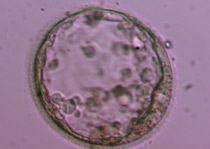 Πλήρης βλαστοκύστη ποιότητας 3CC. Η έσω κυτταρική μάζα και η τροφοβλάστη αποτελούνται από πολύ λίγα κύτταρα.