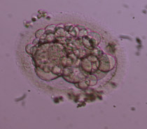Έμβρυο 2ης ημέρας στο στάδιο των 4 κυττάρων 4ης βαθμίδας. Παρατηρείται σχεδόν πλήρης θρυμματισμός και τα βλαστομερίδια είναι δυσδιάκριτα. Θεωρείται έμβρυο πτωχής ποιότητας και δεν επιλέγεται για εμβρυομεταφορά.