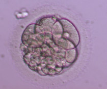 Έμβρυο 3ης ημέρας στο στάδιο των 6 κυττάρων 2-3ης βαθμίδας με μέτριο ποσοστό θρυμματισμού.