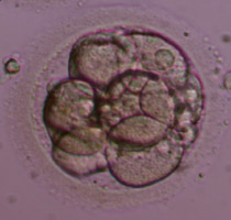 Έμβρυο 3ης ημέρας στο στάδιο των 8 κυττάρων 2-3ης βαθμίδας με  μέτριο ποσοστό θρυμματισμού.