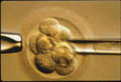 Blastomere biopsy. A single blastomere has been aspirated and is visible inside the biopsy pipette.