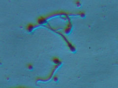 Τα σπερματοζωάρια όπως απεικονίζονται στο μικροσκόπιο (μεγέθυνση x 1000-αρχείο ΕΥΓΟΝΙΑΣ).