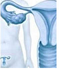 Endometriosis