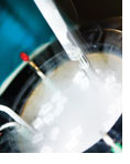 Fertility Preservation (Cryopreservation)