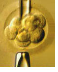 Preimplantation Genetic Diagnosis (PGD)