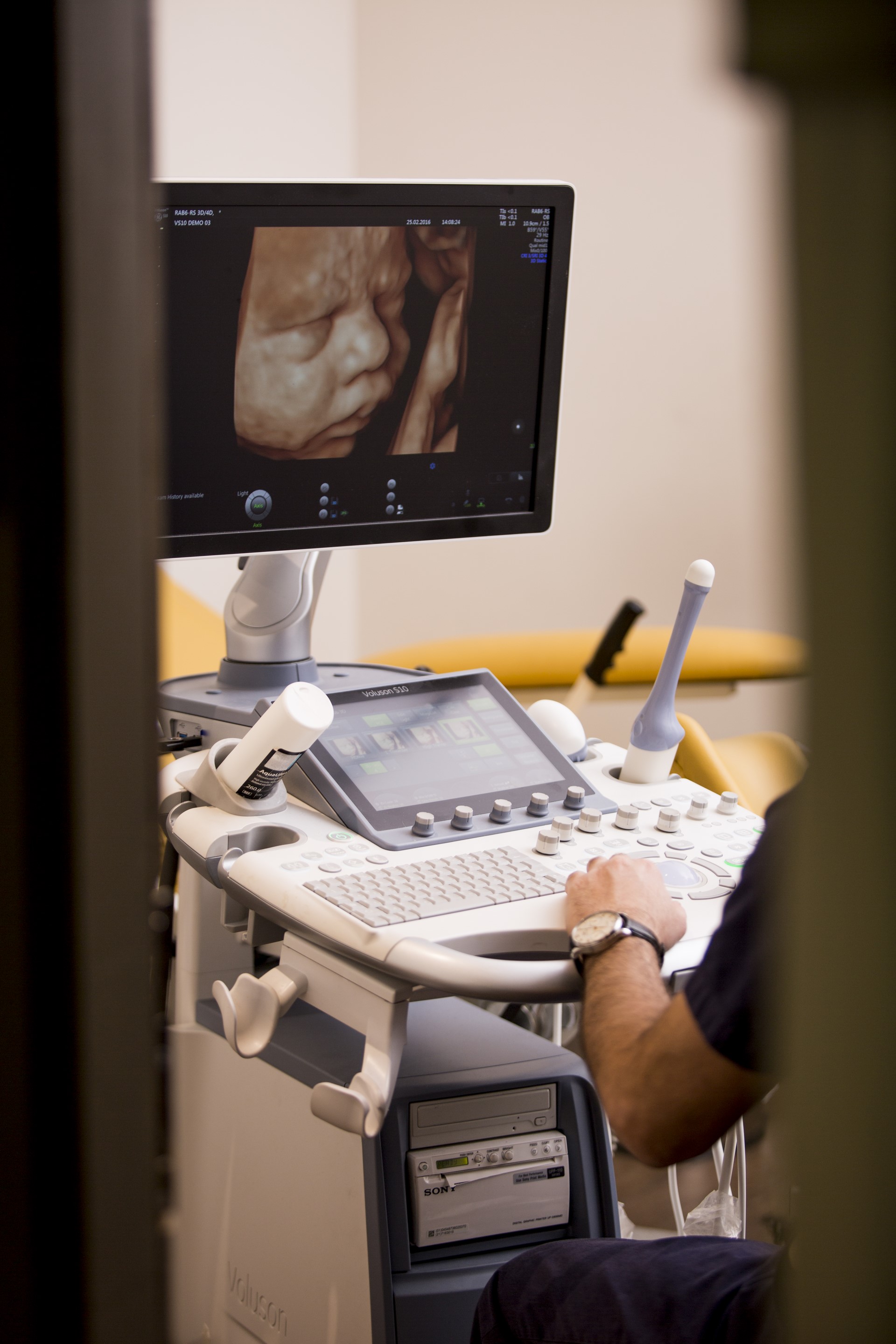 Ongoing pregnancy. Ultrasound imaging of an embryo at 14 weeks of gestation.