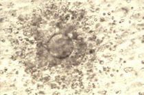Ωοκύτταρο που περιβάλλεται από κοκκιώδη κύτταρα (αρχείο ΕΥΓΟΝΙΑΣ).