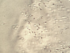 Σπερματοζωάρια όπως απεικονίζονται στο μικροσκόπιο (μεγέθυνση x 500, αρχείο ΕΥΓΟΝΙΑΣ).