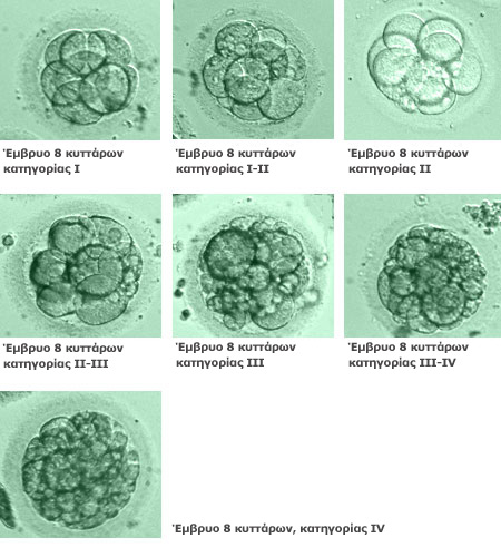 Αξιολόγηση εμβρύων 4 και 8 κυττάρων. Στις εικόνες απεικονίζονται έμβρυα Grade I έως Grade IV, όπως τα αξιολογούν οι εμβρυολόγοι (αρχείο ΕΥΓΟΝΙΑΣ).