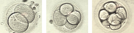 Έμβρυο 2, 4 & 8 κυττάρων (αρχείο ΕΥΓΟΝΙΑΣ).